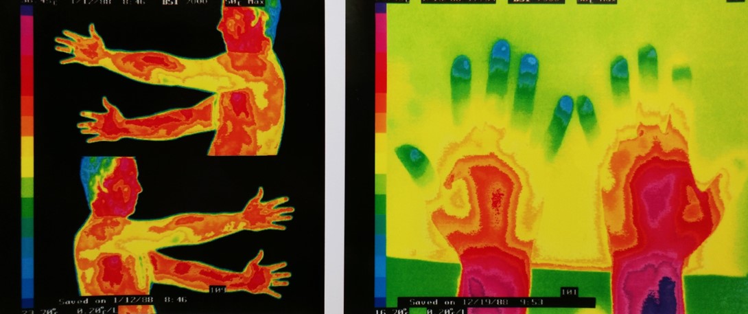 Thermography